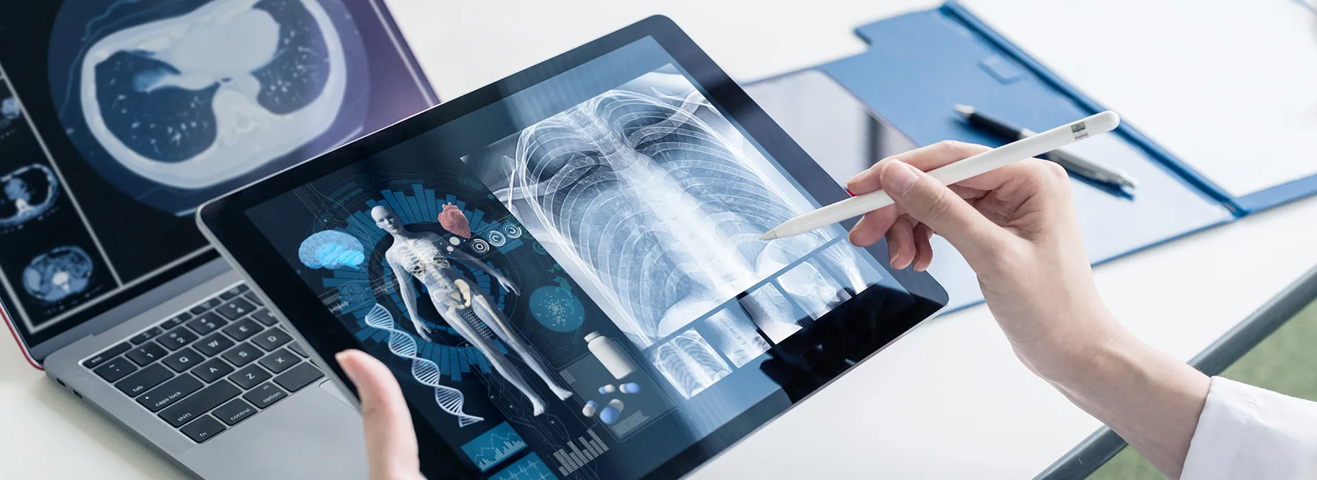 Person looking at x-rays on mobile devices