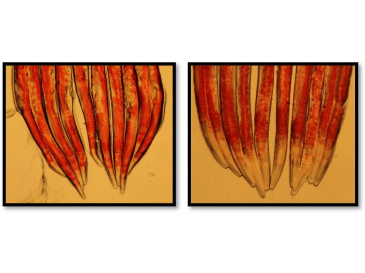 Lipids (stained orange) in C elegans worms fed normal (left) and high cholesterol (right) nutrition.
