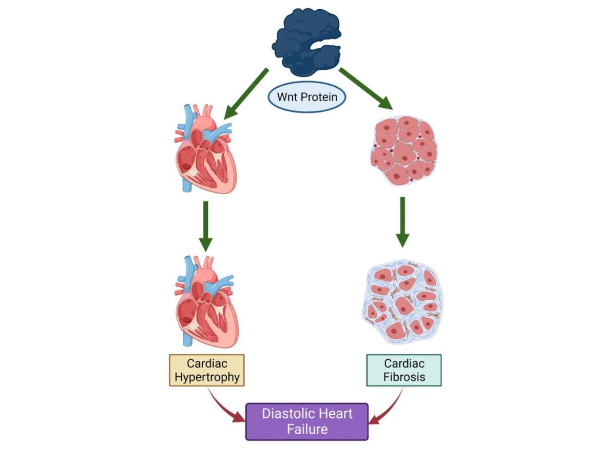 Figure 2. Wnt proteins promote the development of cardiac hypertrophy and fibrosis and consequently DHF