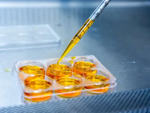 a dropper depositing yellow liquid in a test tray
